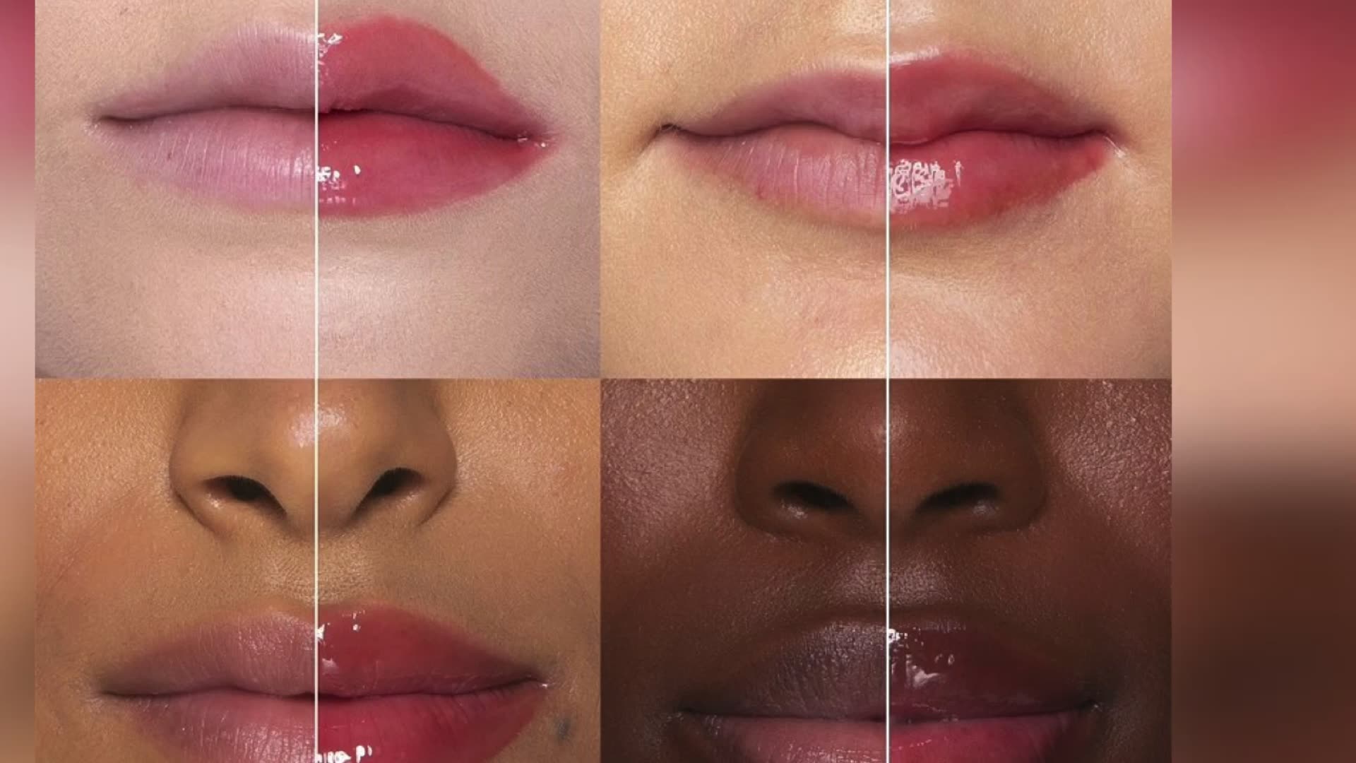 How to Get Natural Pink Lips Without Lipstick