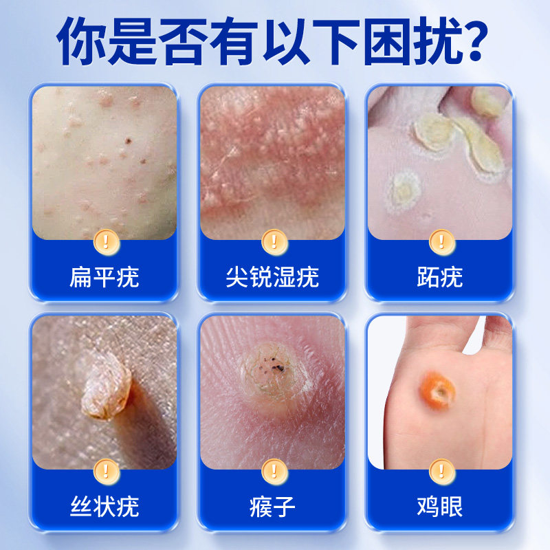 鸡也能聊天？揭秘免费鸡语翻译神器！️