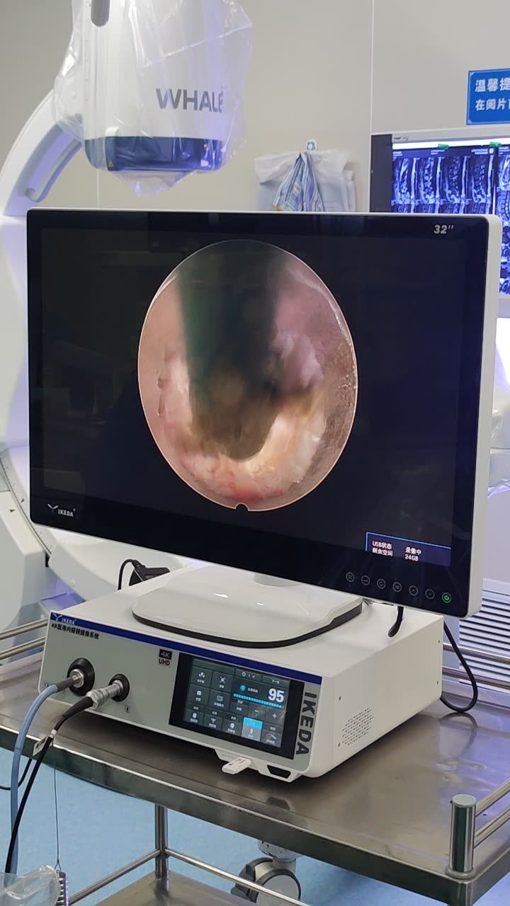 4k Camera Laparoscopy Endoscope Surgical Endoscopy Tower Ykd 9211 Buy