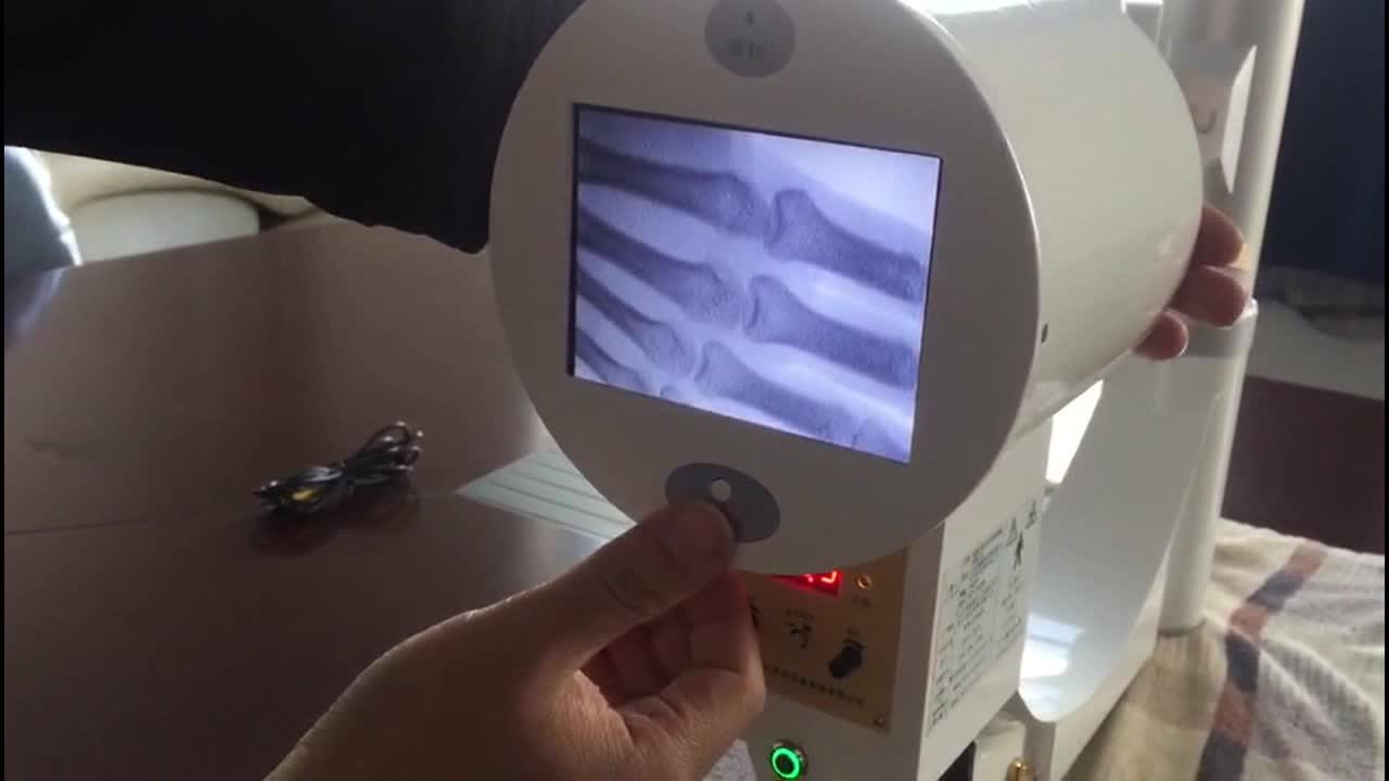 Pediatric Mobile Xray Flaw Detector Diagnostic Xray Machine Price