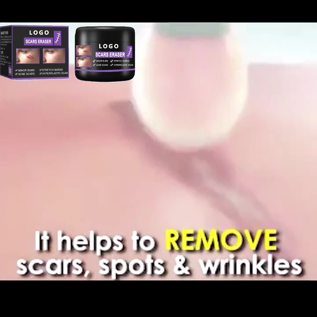 Treatment From Keloid Scars Scar Stain Remover Cream For Scars On Legs