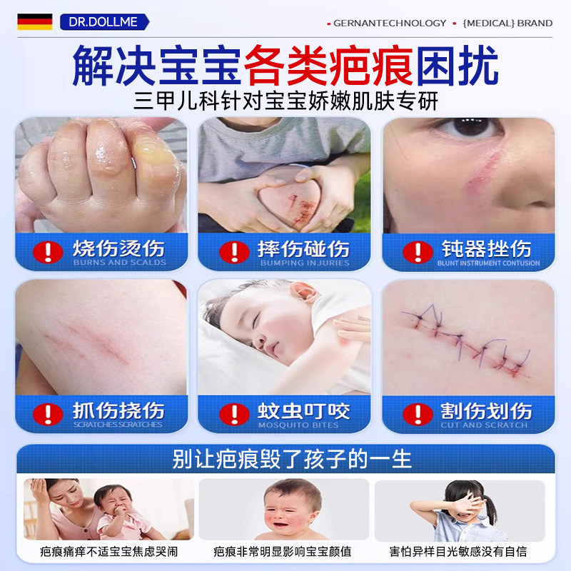 包皮手术后疤痕增生怎么办?成人儿童都适用的修复妙招!-祛疤产品-淘宝百科网