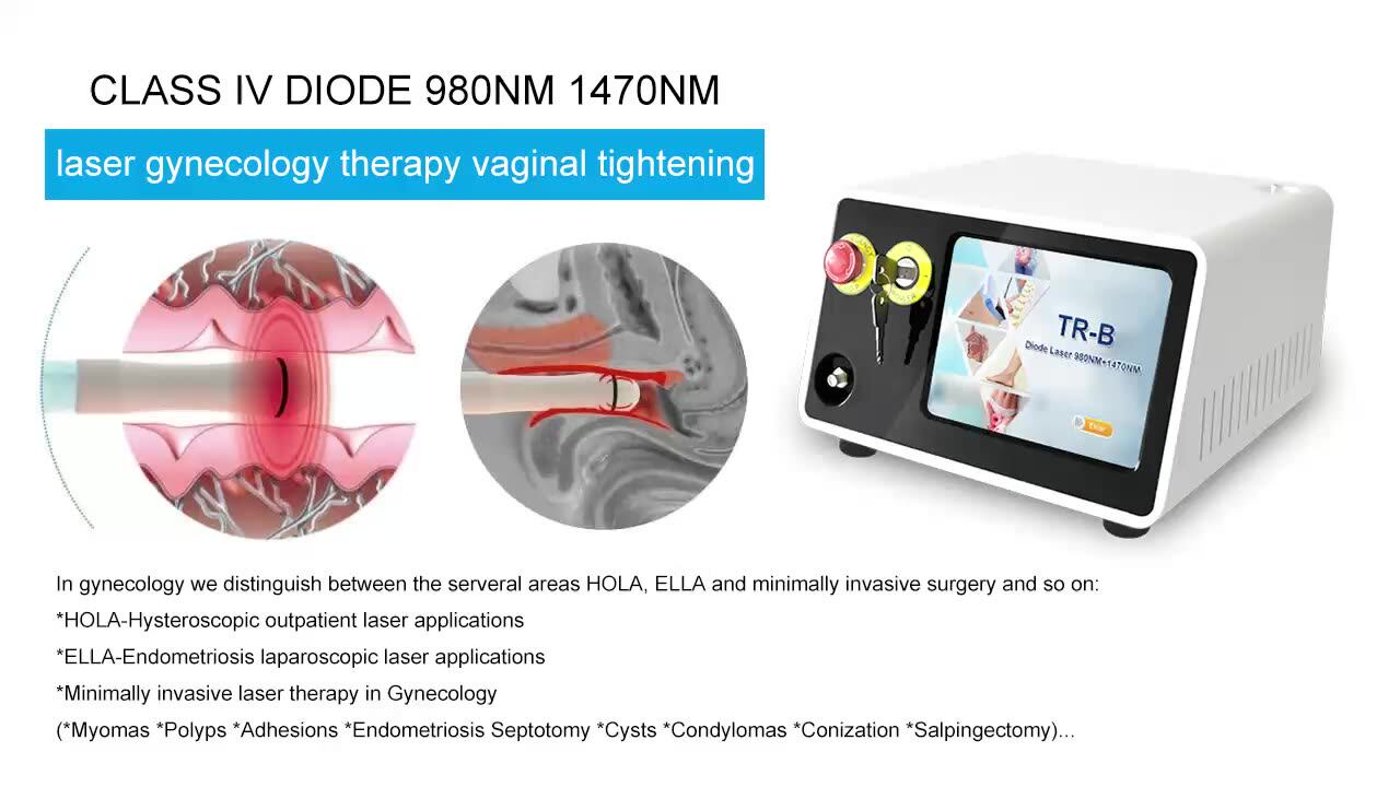 Láser de diodo 1470 para Ginecología para estiramiento vaginal y