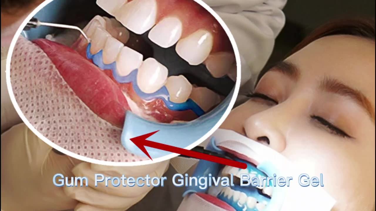 Black Syringe Blue Gel Mint 3ml Gingival Protection Barrier Gum