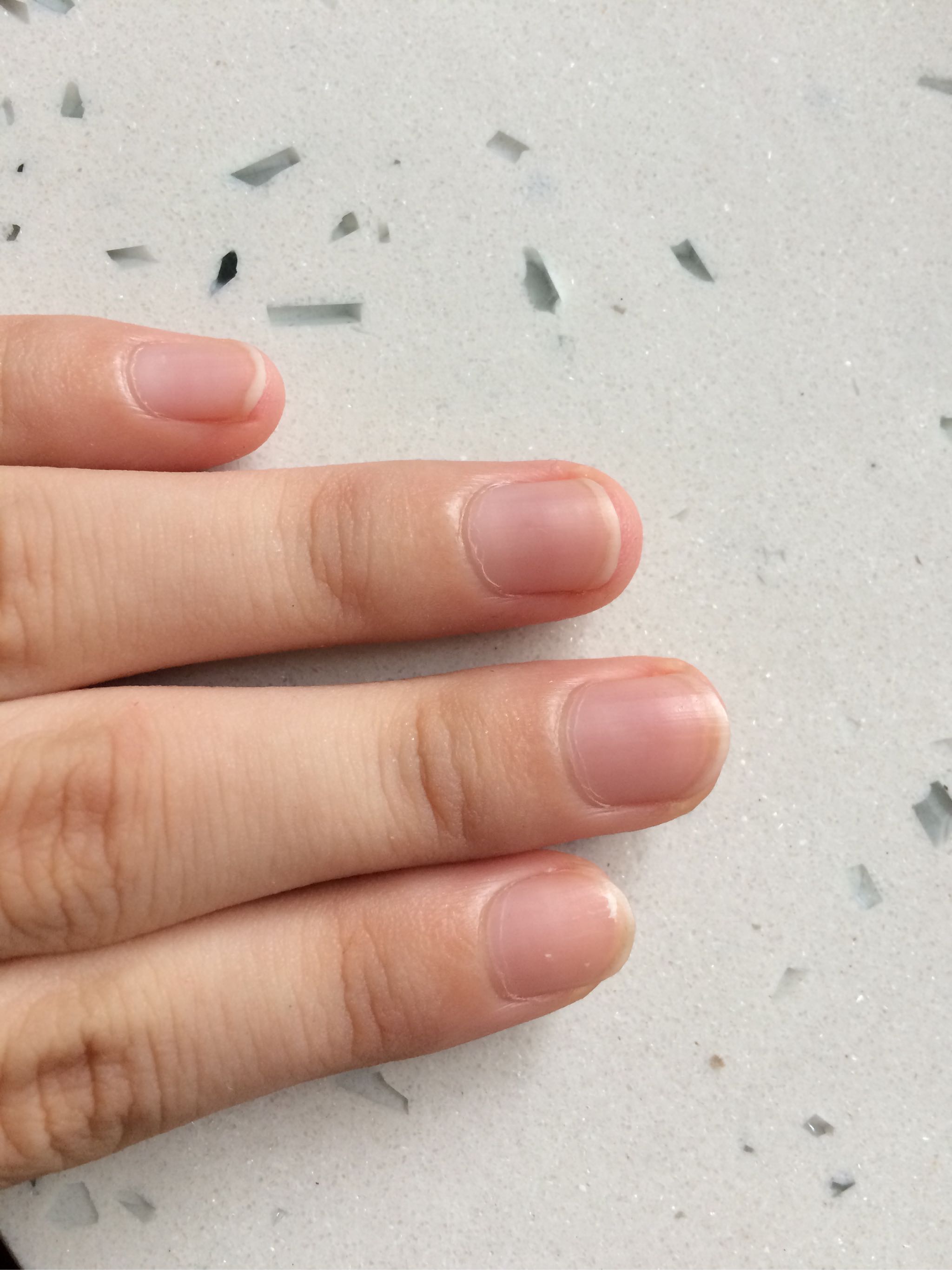 小麦胚芽精华 VE死皮软化剂好不好用，是什么牌子,第6张