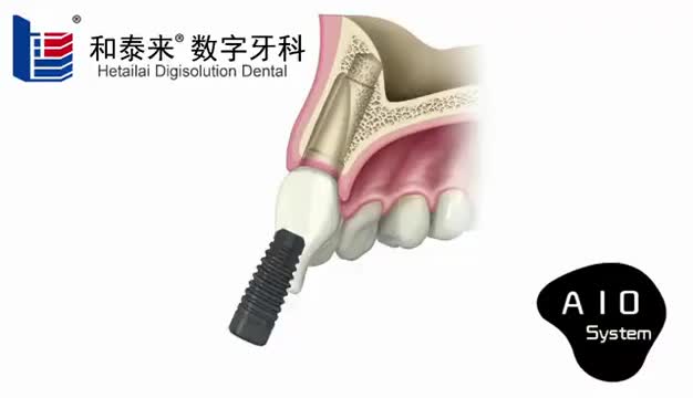 Ce Licence Number And Implant Materials & Artificial Organs Properties