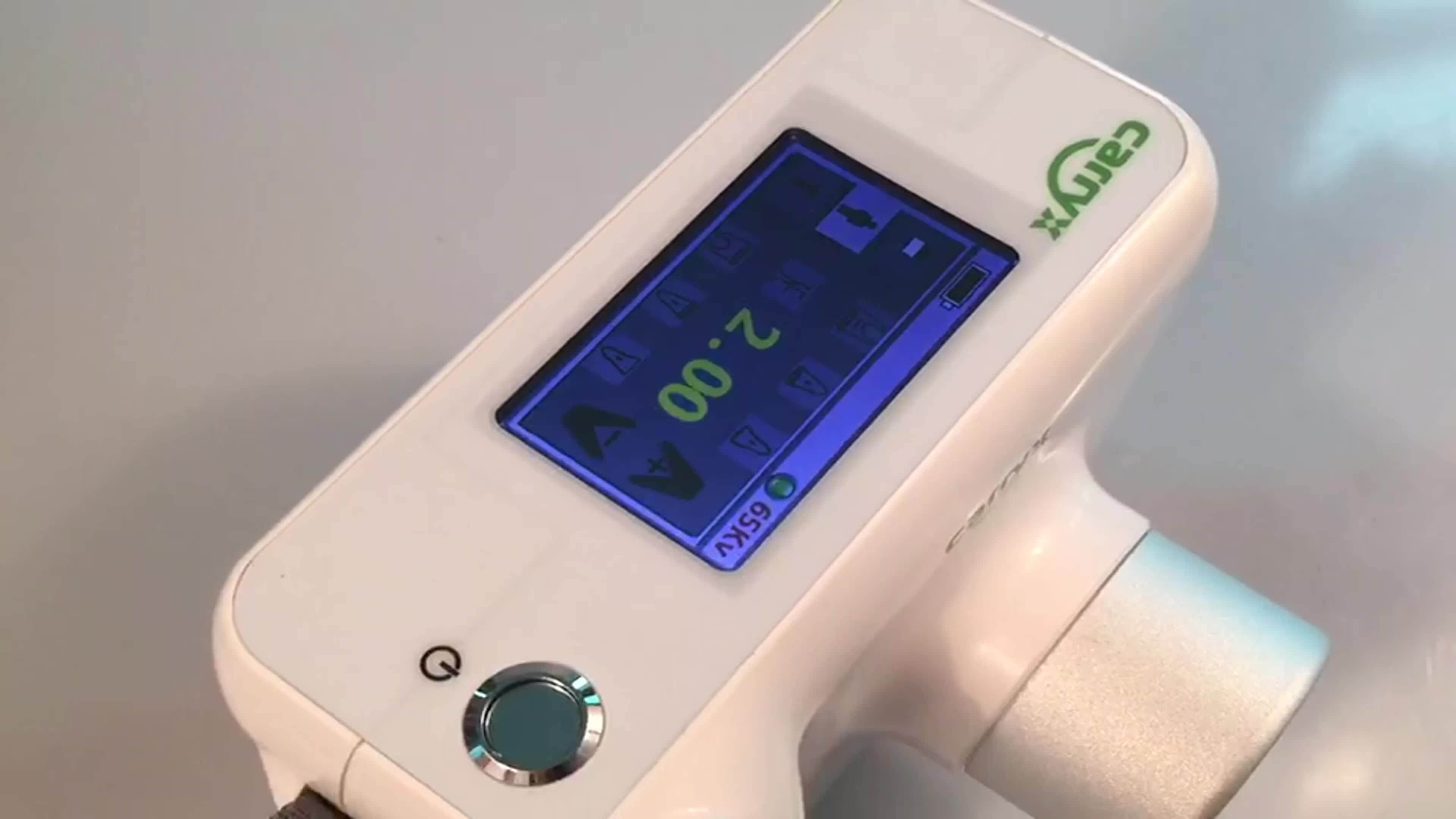 65kv 2ma Digital Portable Dental X Ray Machine Buy Dental X Ray