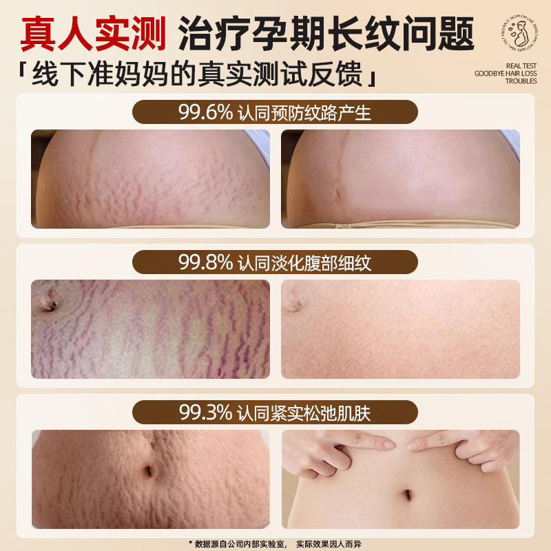 告别妊娠纹，迎接光滑肌肤！全身淡纹身体乳妊娠纹油孕妇专用产后预防淡化紧致肚皮精华护肤品