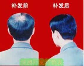 Extension mèches - Ref 225713 Image 34