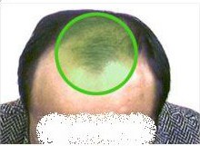 Extension mèches - Ref 225713 Image 50