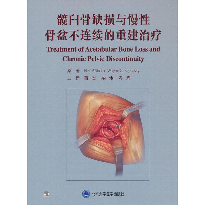 [Authentic New Book with Fast Delivery] Reconstruction and Treatment of Acetabular Bone Defects and Chronic Pelvic Discontinuity [Us] Neil Seth, 9787565932434