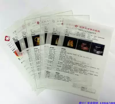 A4 Color ultrasound negatives Medical negatives)Color ultrasound negatives)B ultrasound negatives) MPET negatives)Double-sided laser photocopying paper