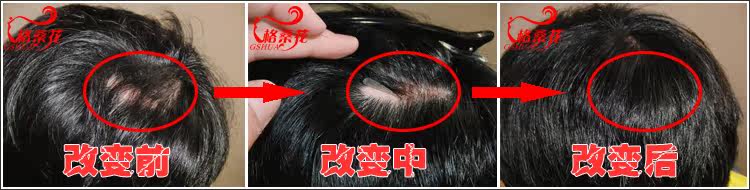 Extension cheveux - Ref 217271 Image 6