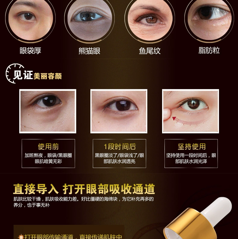 BD Eye Care Authentic Golden Eye Serum 祛 nếp nhăn mắt làm mờ quầng thâm dưỡng ẩm