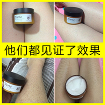 nuria Nuriya body lotion moisturizing cream fish scales snake skin goose skin bumps hair follicles Keratinization