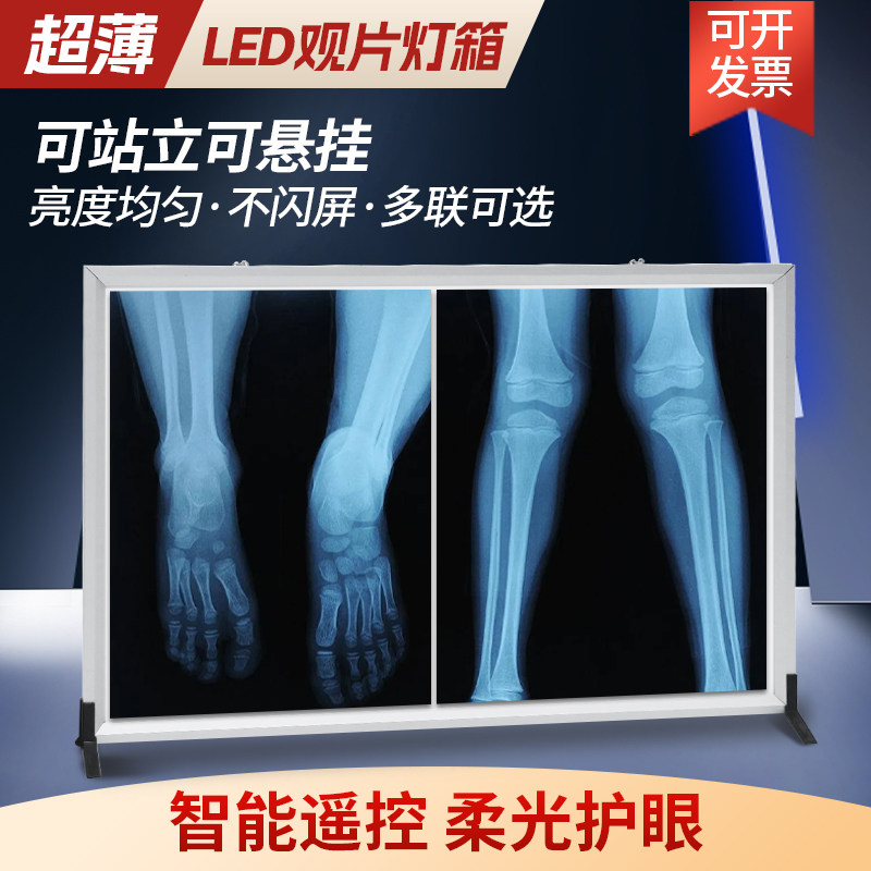 超薄医院X光观片灯led牙科阅片灯看片灯CT片单联双联骨科观片灯箱