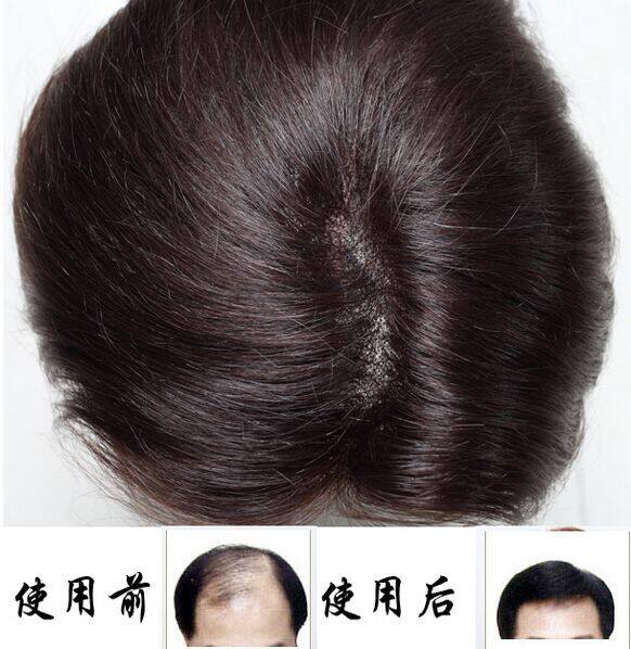 Extension cheveux - Ref 225416 Image 39