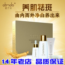 Silando Huanyan whitening freckle cream melanin set to remove chloasma genetic freckle lightening facial