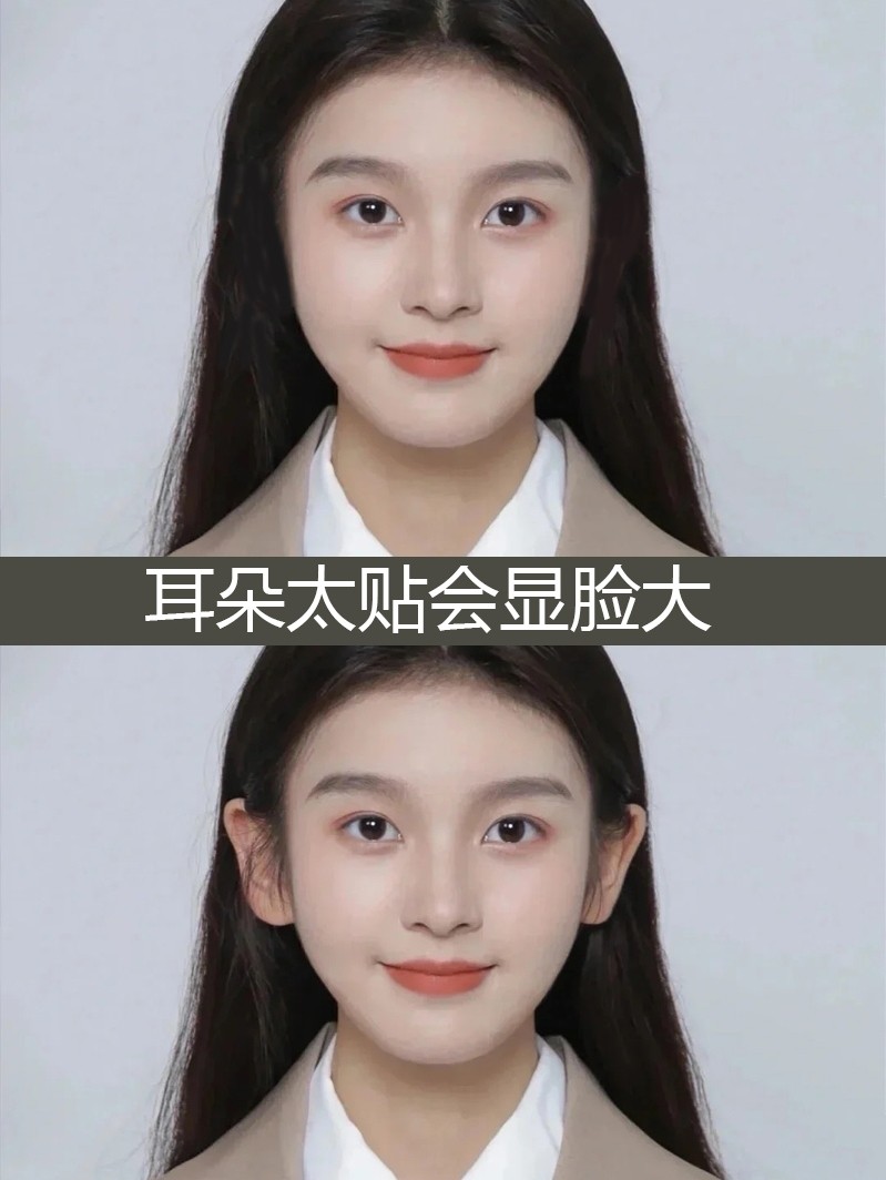 Genie Ear Deity Styling Ear Pearl Veneered deity Ears Straightener Invisible large face Invisible Large Face to Wind Ear Deity