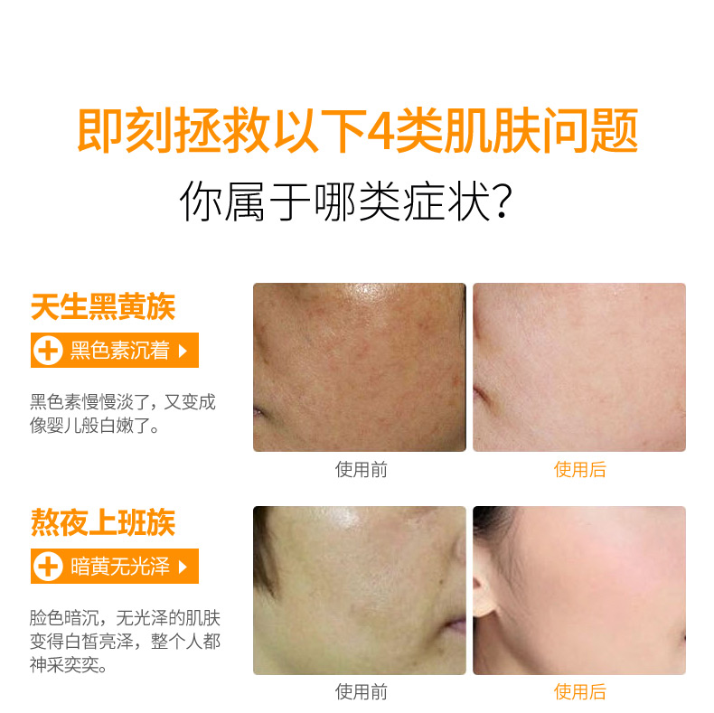 Làm trắng da thực phẩm Ampoule tinh chất dưỡng ẩm tàn nhang làm sáng da săn chắc da mặt axit hyaluronic giải pháp tinh chất the ordinary