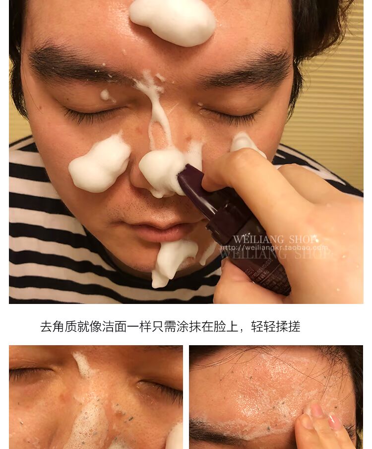 Hàn quốc NEOGEN Nicholas Moss Tẩy Tế Bào Chết Facial Nữ Men Body Deep Cleansing Tẩy Tế Bào Chết Mụn Đầu Đen Chà tẩy tế bào chết the face shop