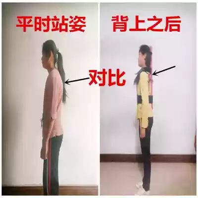 Military posture frame Positive stride frame Military posture correction Swing arm frame Positive stride queue training cross correction Shoulder and chest humpback