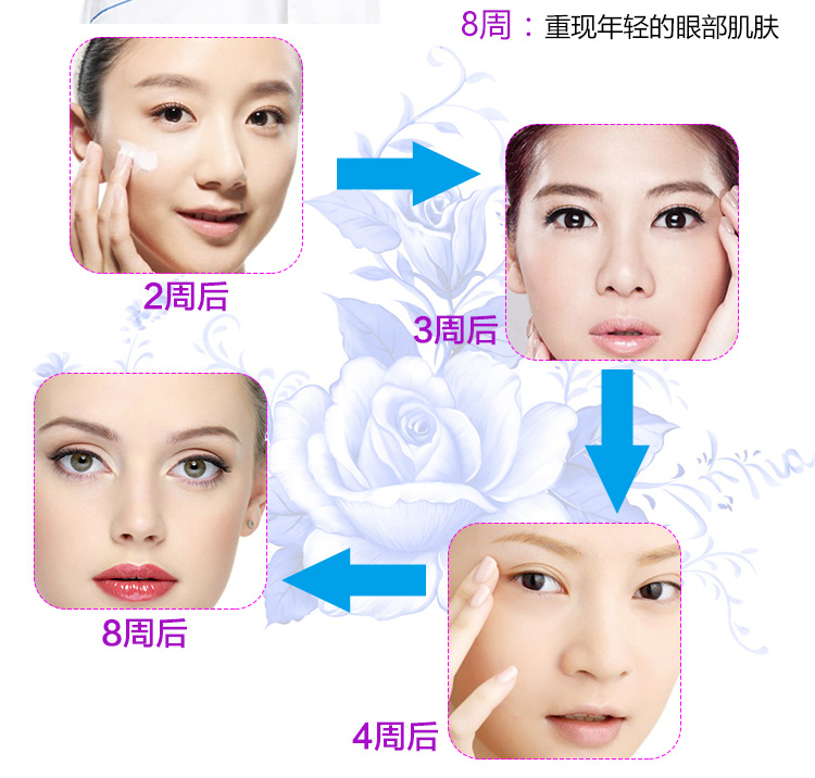 Kem dưỡng mắt Freezeframe của Úc cho nếp nhăn ff chăm sóc mắt cho túi mắt quầng thâm làm mờ nếp nhăn 15ml kem xóa nếp nhăn