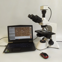 Computer digital difference microscopy with a microscope with a microscope