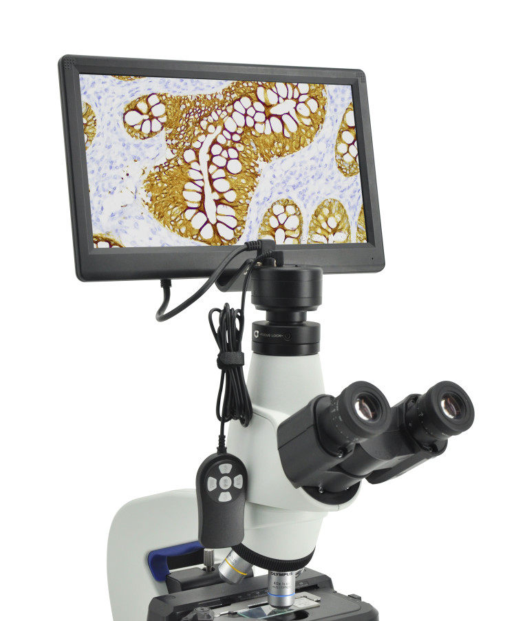 Microscope dedicated 12 5-inch HDMI high-definition display image acquisition and display integrated imaging system