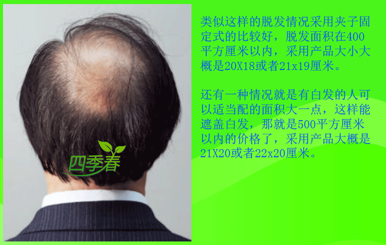 Extension mèches - Ref 224406 Image 10