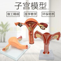 Human female reproductive uterine anatomy pathological model Vaginal ovary teaching model Gynecological reproductive teaching tool