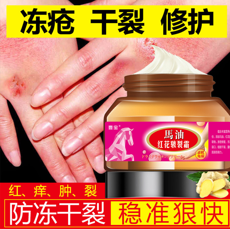 Horse oil safflower chapped cream winter anti-freeze anti-dry anti-crack cream chilblain cream heel dry cracked cracked moisturizing skin itching
