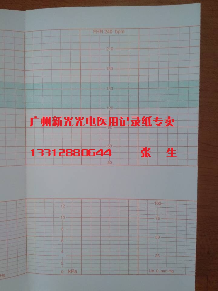 Shandong Thai medical TS5001 5002 fetal monitoring paper Thai medical 9001 9002 152*90-150P fetal monitoring paper