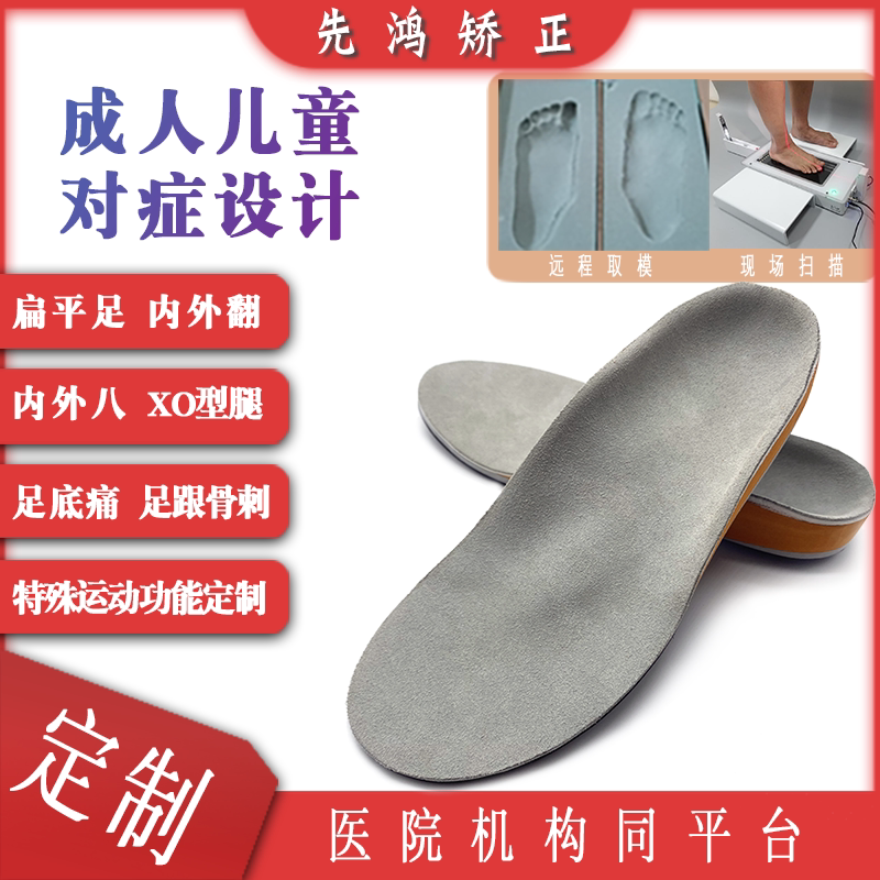 Flat Foot Customized Computerized Insole 🌟 Good news to solve foot problems - flat foot orthopedic 3d ...