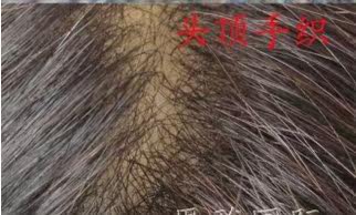 Extension cheveux - Ref 220154 Image 70