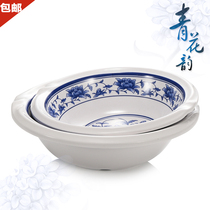 A5 Qinghua Porcelain Melamine Large Bowl Creativity Restaurant Hotel Water Cooking Fish Sour Vegetable Fish Basin Soup Pan Bowl Plastic Large Bowl Commercial