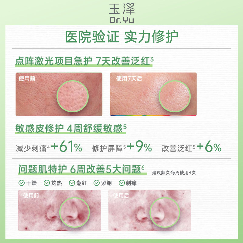 玉泽 积雪草安心修护干面膜 6片 聚划算多重优惠折后¥23.04包邮 淘金币可抵扣2.19元 88VIP会员还可95折