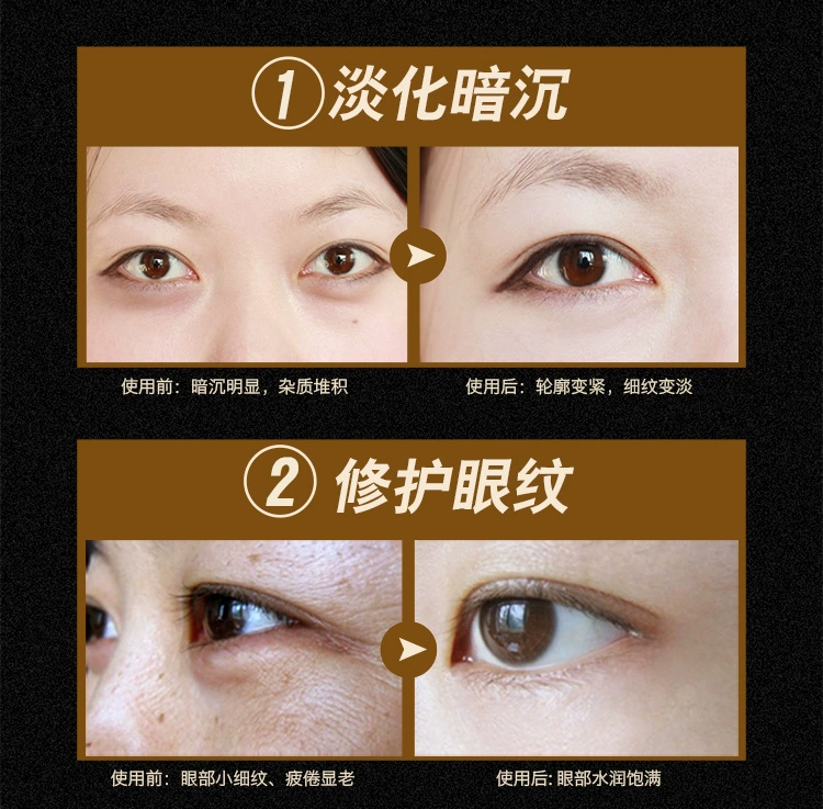 Black Pearl Lady Eye Mask Stick Giữ ẩm cho Dark Eye Eye Bag Kéo Nâng mắt Chăm sóc 30 Cặp chính hãng