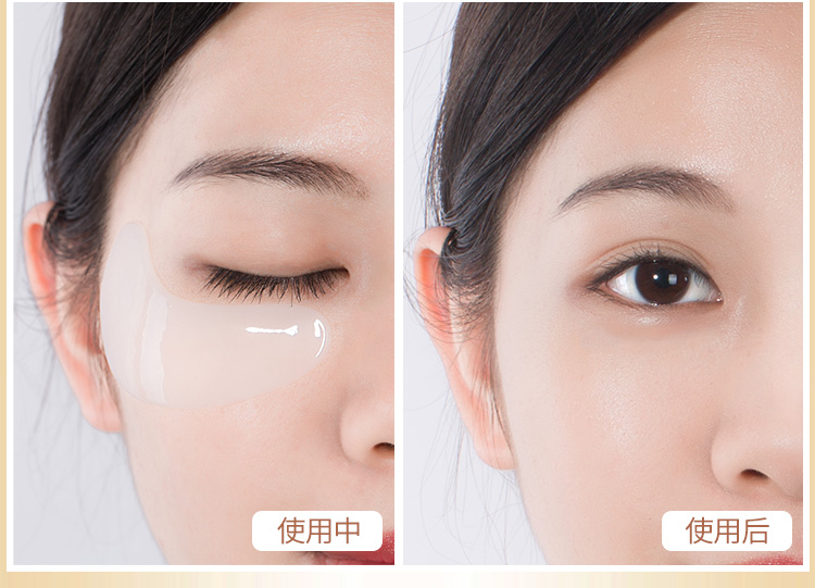 Sáo tình yêu ốc mắt phim để mắt túi nếp nhăn để quầng thâm mắt túi dưỡng ẩm làm săn chắc mắt chăm sóc mặt nạ mắt serum trị thâm mắt