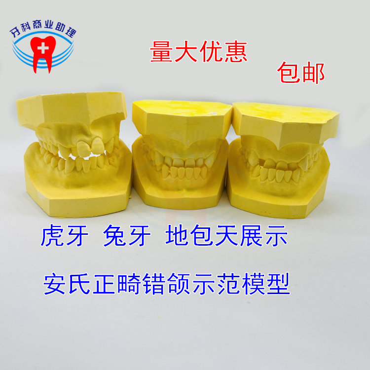 牙科 安氏正畸错颌石膏展示模型123类错颌牙列对比模型兔牙地包天