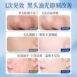 Средство для удаления прыщей от черных точек с салициловой кислотой, увлажняющая маска для лица, очищение пор, глубокое очищение, легкое нанесение