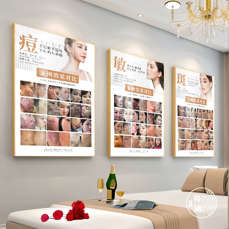 Acne Scar Repair Decorative Painting, Medical Beauty Skin Management Poster, Beauty Salon Skin Problem Wall Art