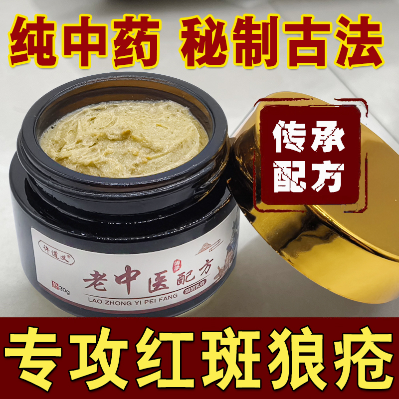 Topical Skin Ointment for Treating Symptoms of Acute Systemic Lupus Erythematosus in the Form of Butterfly-Shaped Plaques, a Skin Care and Health Product Topical Skin Ointment for Treating Symptoms of Acute Systemic Lupus Erythematosus in the Form of Butterfly-Shaped Plaques, a Skin Care and Health Product
