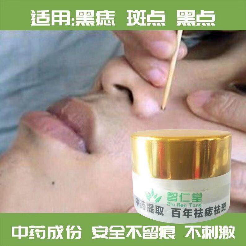 Zhiren Hall Point Mole Cream to dispel the mole Dispatches