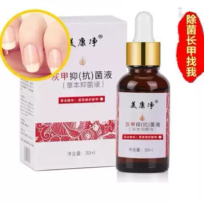 Meikangjing nail fungus antibacterial liquid Special drugs to remove nail fungus potion parotiditis soft nail herbal ointment antibacterial liquid