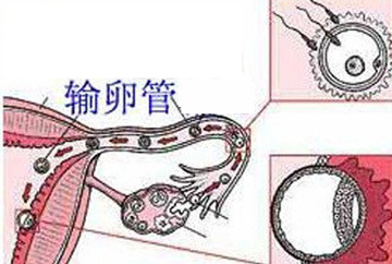 孕前检查项目输卵管状态