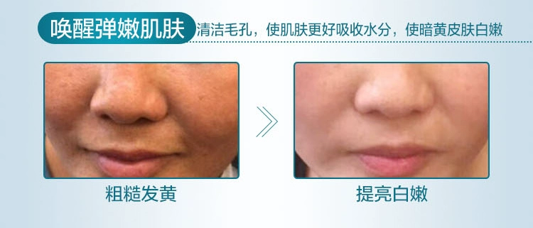 Authentic Purifying Rejuvenation Detox Cream Nữ Face Facial Beauty Salon Massage đặc biệt Kem làm sạch sâu lỗ chân lông