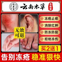 dong chuang gao zhi gen antipruritic frostbite swelling Frost crack flagship store frozen hand children face ears cream