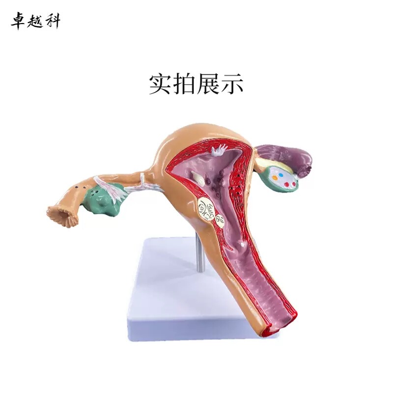Female Pathological Uterus Model, Female Reproductive Organ, Ovary, Uterus Structure, Anatomy, Advanced Simulation of Pathological Uterus Model