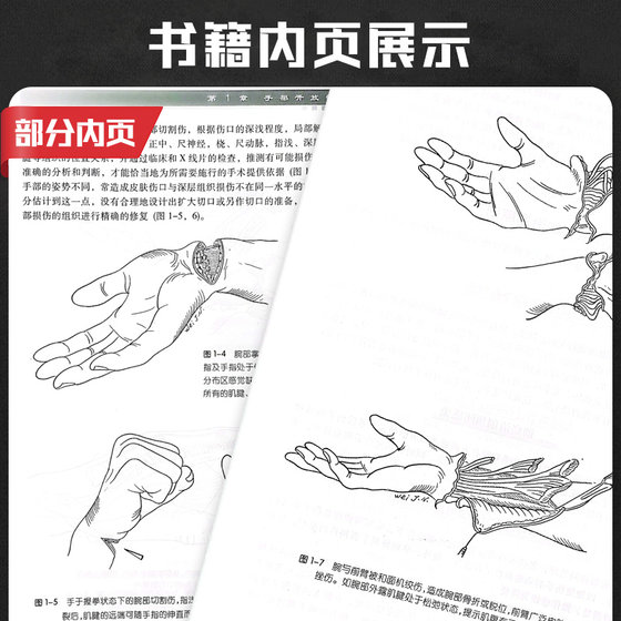 Wei Jianing's hand surgery atlas Wei Jianing's surgeon's surgical reference book Wei Jianing's surgical book People's Medical Publishing House Surgery